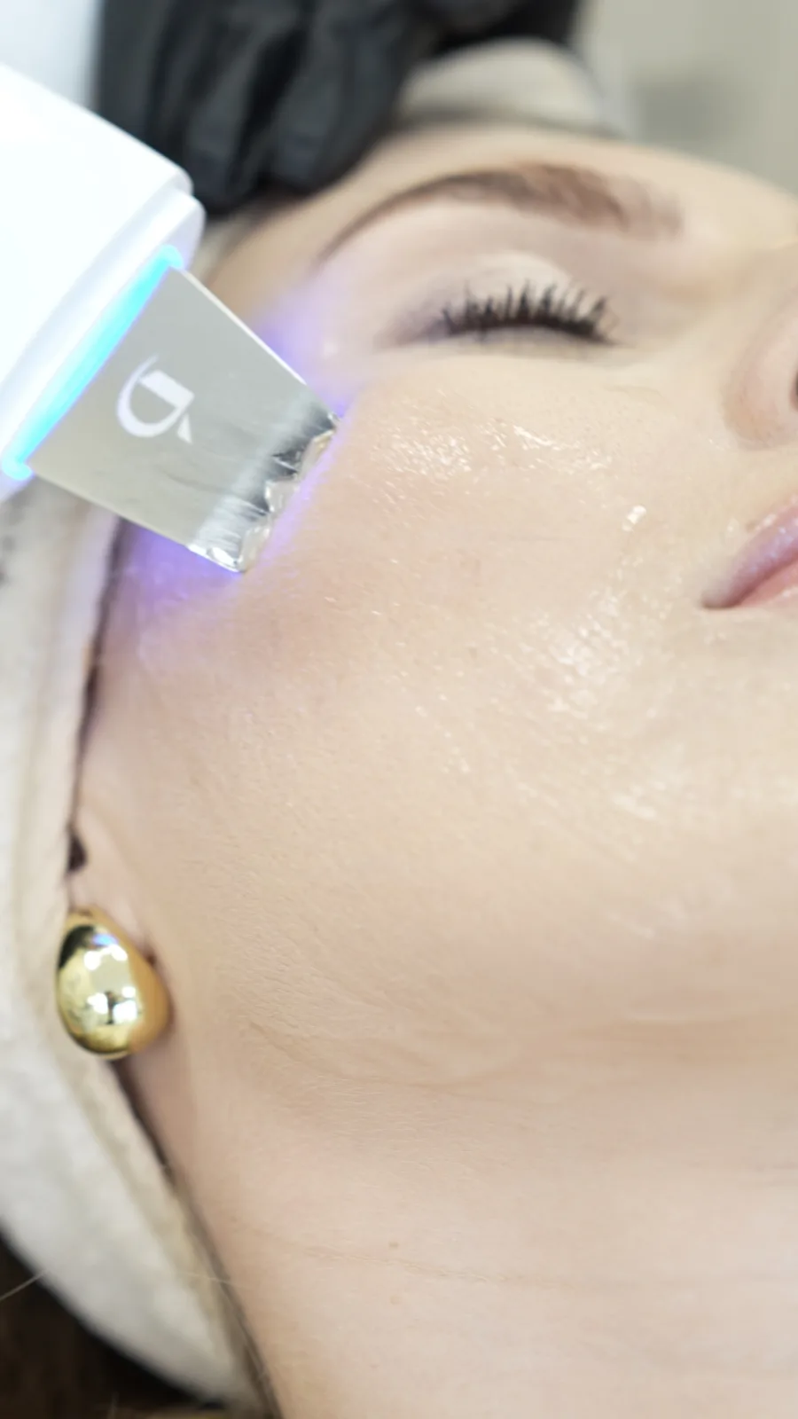 HydraFacial процедура за лице — чиста и сияйна кожа